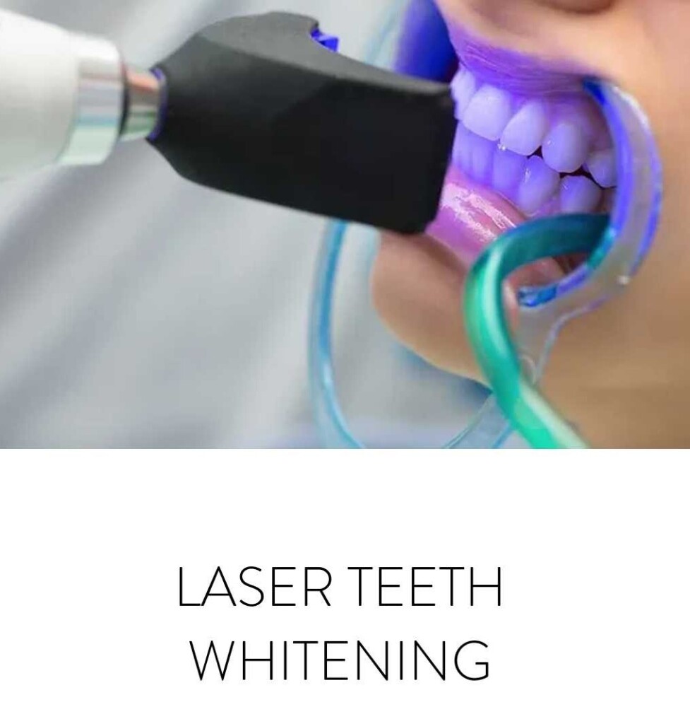 Laser Teeth Whitening